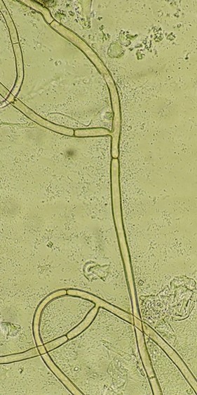病原菌の菌糸の画像