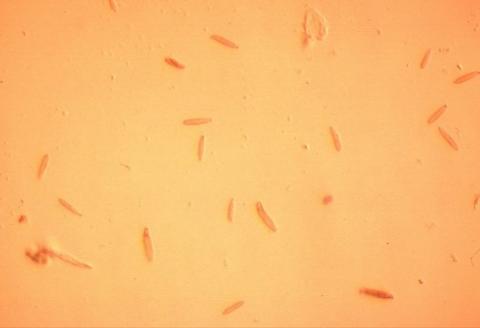 病原菌の分生子の画像