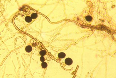 病原菌の分生子の画像