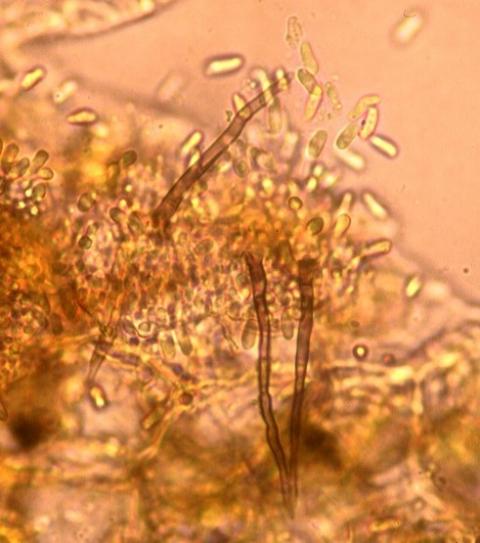 剛毛と分生子の画像