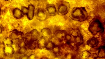 小黒点に見える分生子層の画像