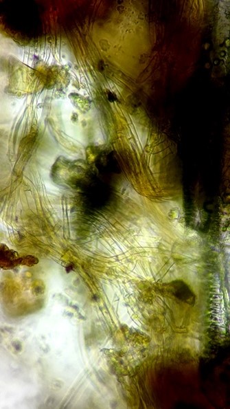病原菌の菌糸の画像