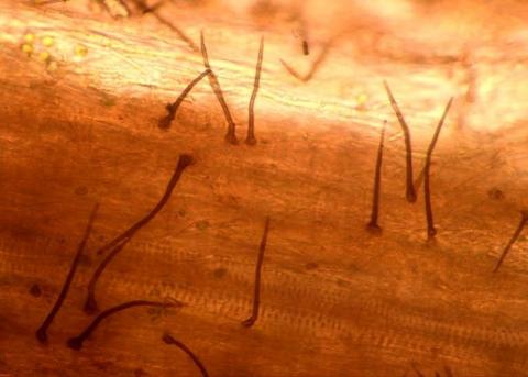 病原菌の剛毛の画像