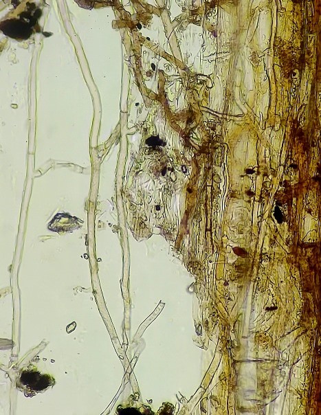 病斑上の菌糸の画像