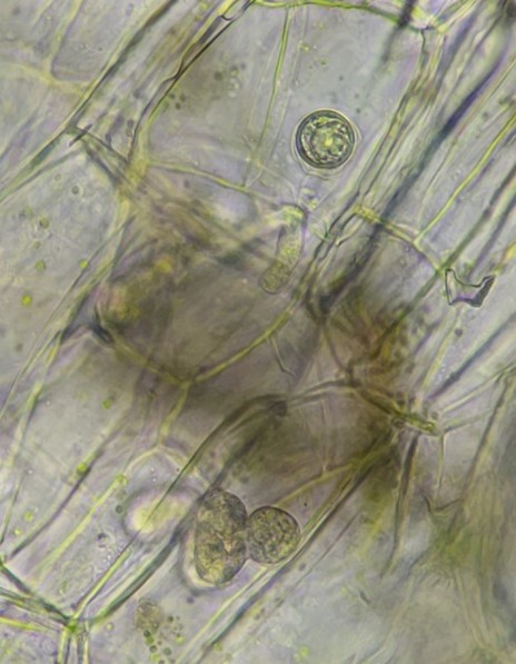 卵胞子と菌体の画像