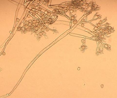 葉裏の分生子柄と分生子