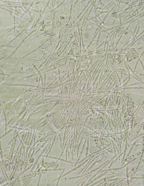 分生子の画像