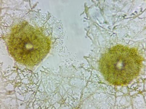 分生子殻と分生子の画像