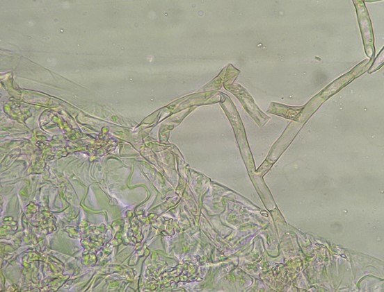 菌糸の画像