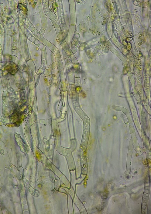充満する菌糸の画像