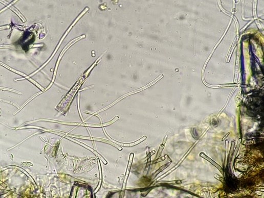 分生子の画像