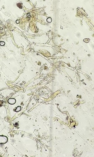 全身症状株表面に密生する分生子柄