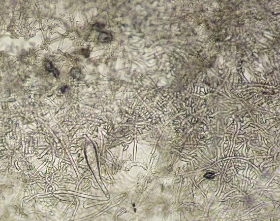 分生子の画像
