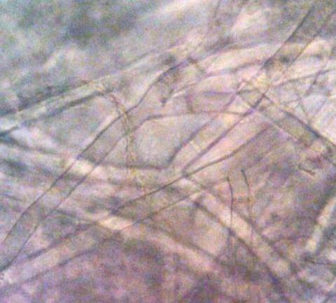 横縞上にはびこる菌糸の画像