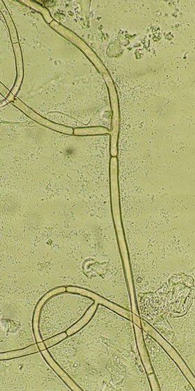 病原菌の菌糸の画像