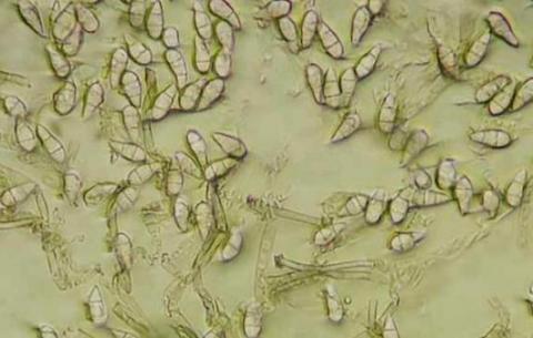 灰白色部分の分生子の画像