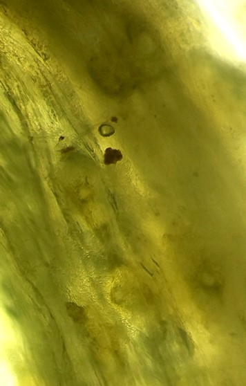 分生子殻の画像
