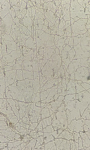 菌糸の画像