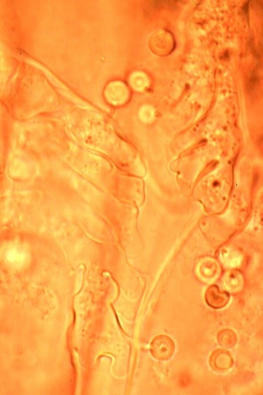 病原菌の画像