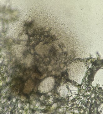 病原細菌の画像