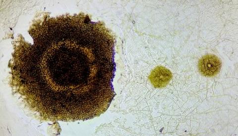 すす点病の菌糸組織と、すす斑病の分生子殻の画像