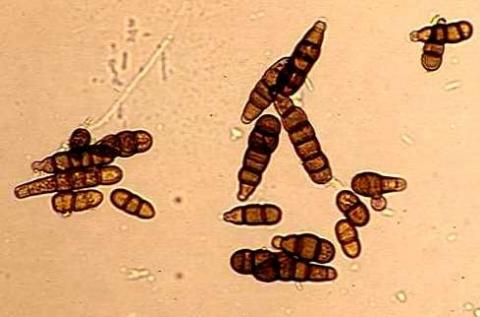 病原菌の分生子の画像