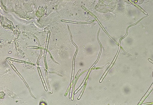 鞭状の分生子の画像