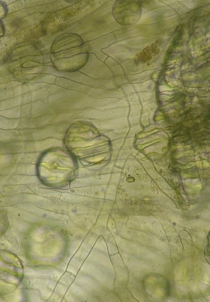 T字型の菌糸の画像