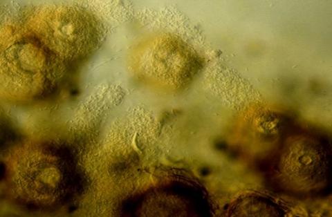 分生子殻の画像