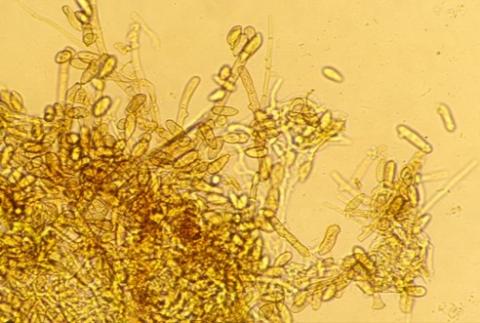 葉かび病の分生子