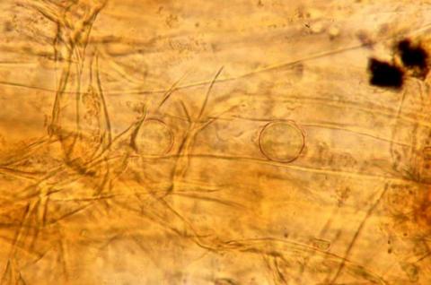 病原菌の卵胞子の画像