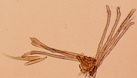 束状の分生子柄と分生子の画像