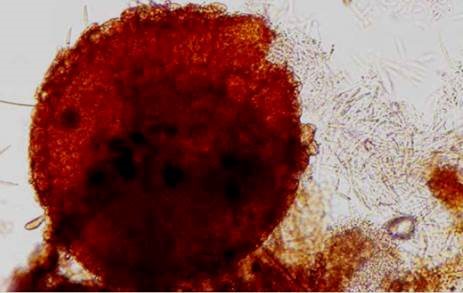 病原菌の子のう殻の画像