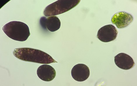 分生子柄と分生子の画像
