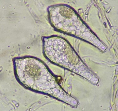 ラッキョウ型の分生子の画像