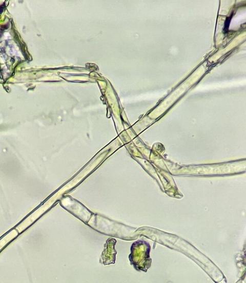 T字型菌糸の画像