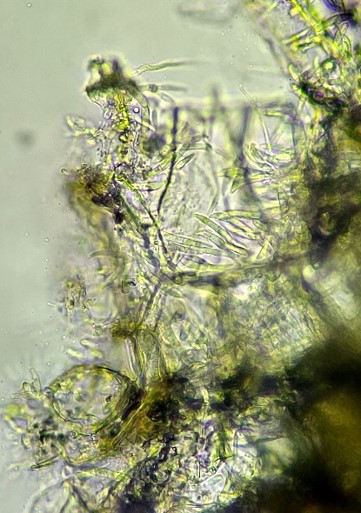 フザリウム菌大型分生子分生子座の画像
