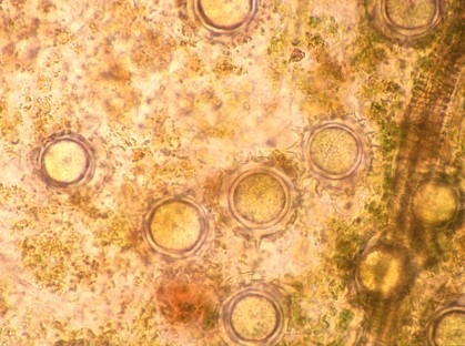 卵胞子の画像