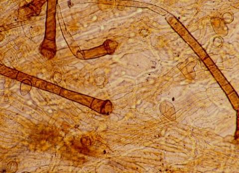 同化菌糸と分生子柄の画像
