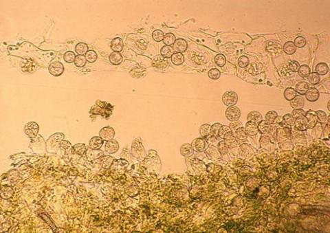 分生子の画像
