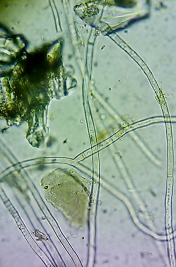 リゾクトニアの菌糸の画像