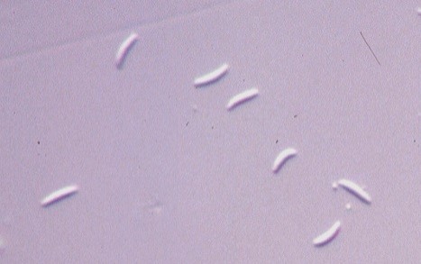 分生子の画像