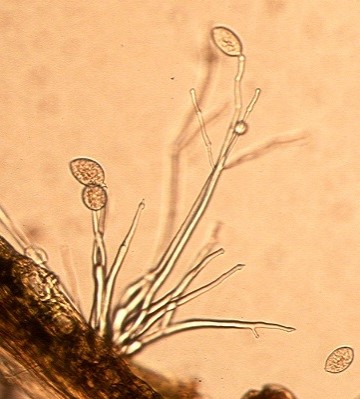 病原菌の分生子の画像