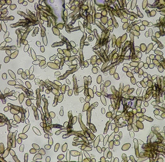 分生子塊の画像