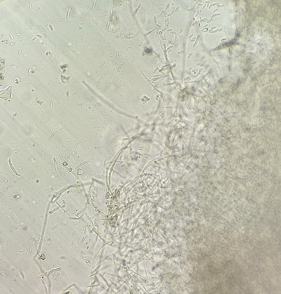 密生する菌糸の画像