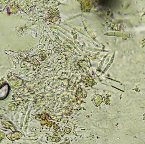 病原菌の分生子塊の画像