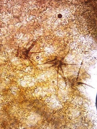 病原菌の分生子層と剛毛の画像