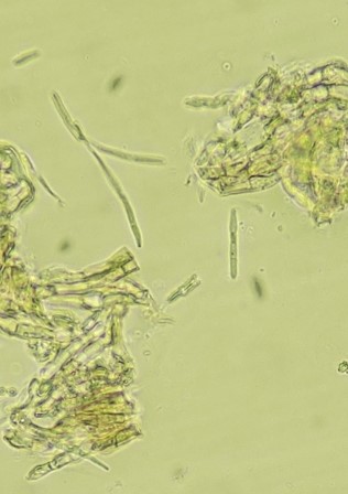 病原菌の分生子の画像