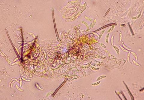 病原菌の分生子と剛毛