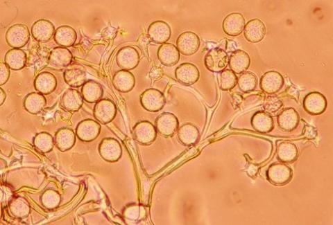 病原菌の分生子柄と分生子
